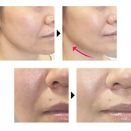 Антивозрастной тональный кушон AMARANTH Dr.Soie 5G Lift Foundation, оттенок бежевый (12 гр)